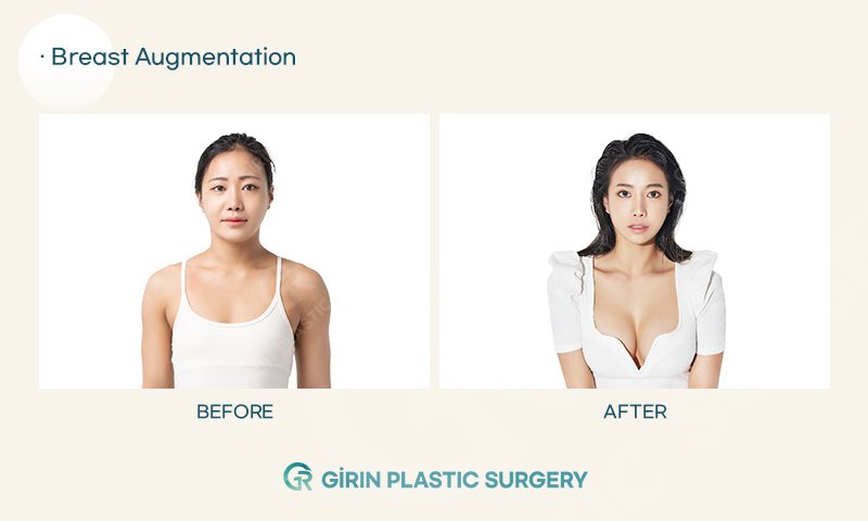 Girin Plastic Surgery - Girin Plastic Surgery