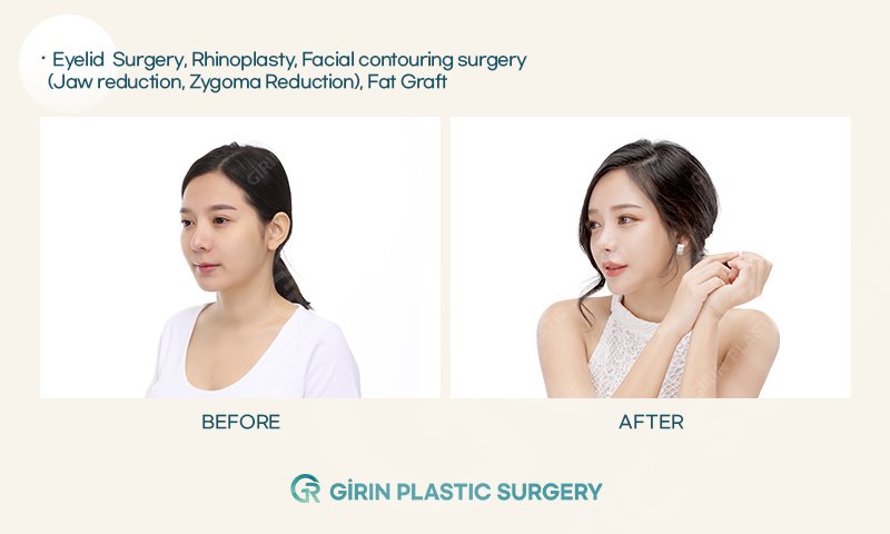 Girin Plastic Surgery - Girin Plastic Surgery