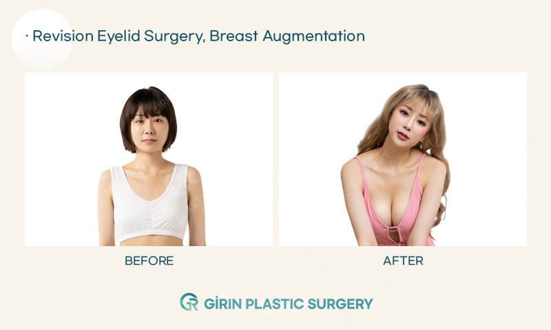 Girin Plastic Surgery - Girin Plastic Surgery