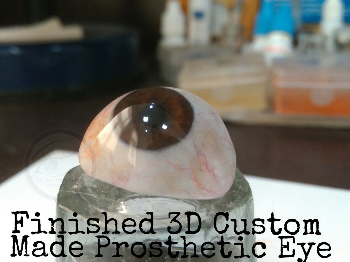 Global Prosthetic Eye Center ,Delhi - Global Prosthetic Eye Center ,Delhi