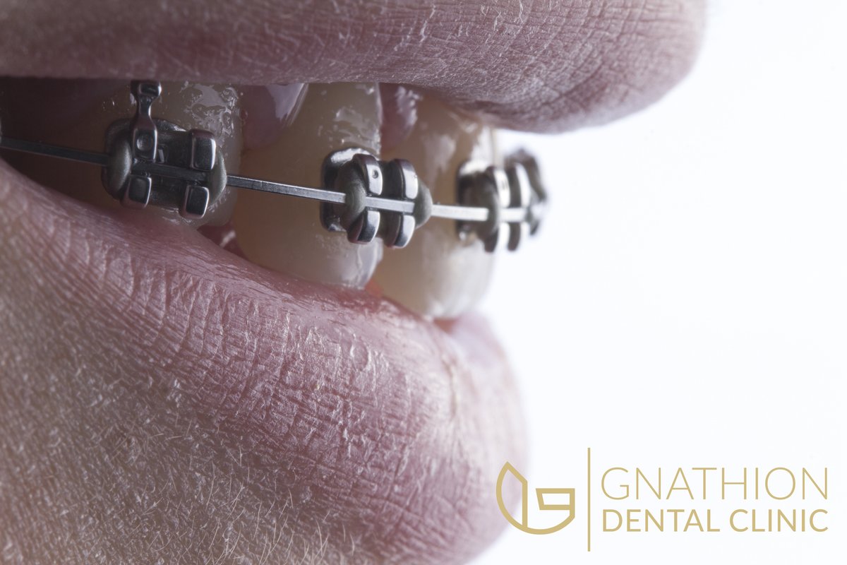 Gnathion Dental Clinic - Gnathion Dental Clinic