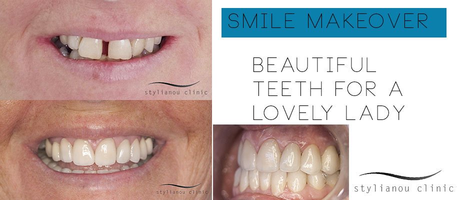 Gnathion Dental Clinic - Gnathion Dental Clinic
