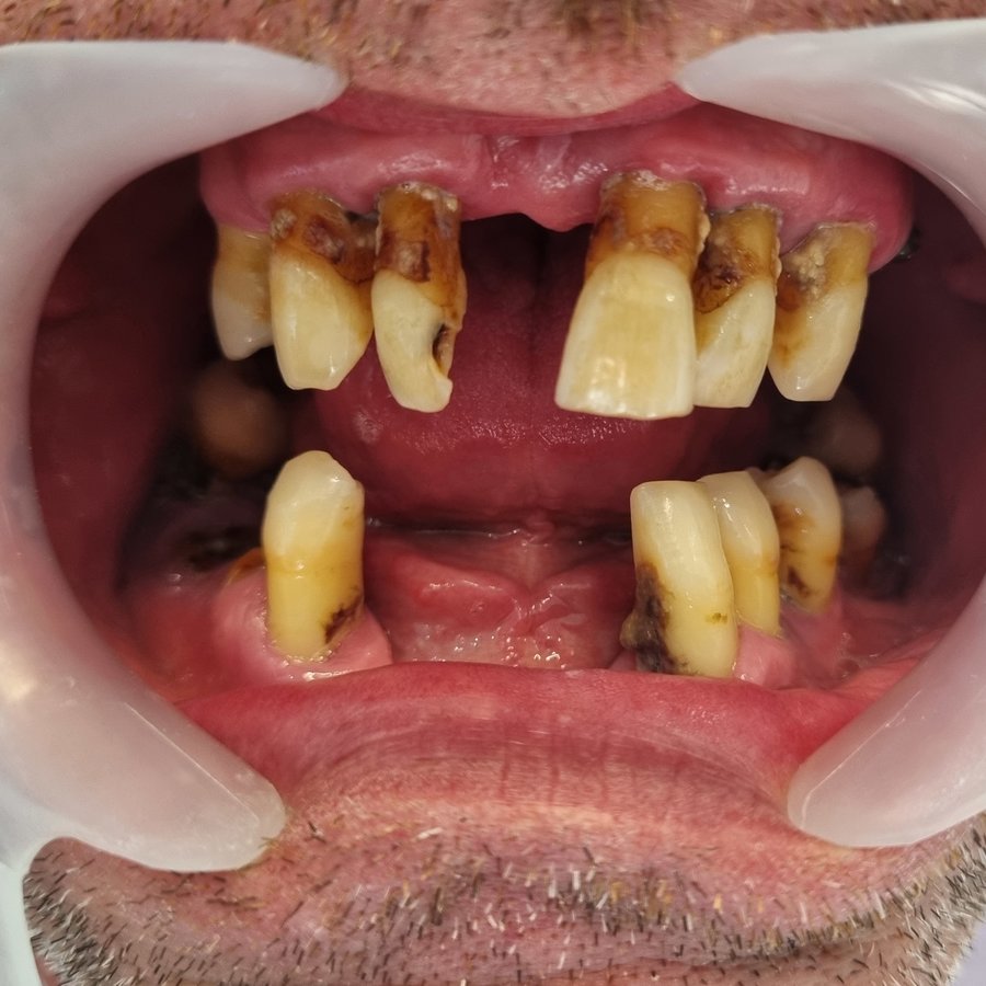 عيادة جوتشيك دنت لصحة الفم والأسنان - Gocek Dent Oral and Dental Health Clinic