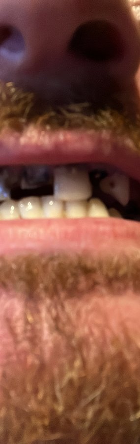 عيادة جوتشيك دنت لصحة الفم والأسنان - Gocek Dent Oral and Dental Health Clinic