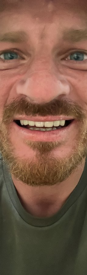 عيادة جوتشيك دنت لصحة الفم والأسنان - Gocek Dent Oral and Dental Health Clinic