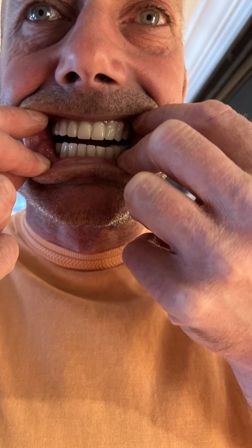 عيادة جوتشيك دنت لصحة الفم والأسنان - Gocek Dent Oral and Dental Health Clinic