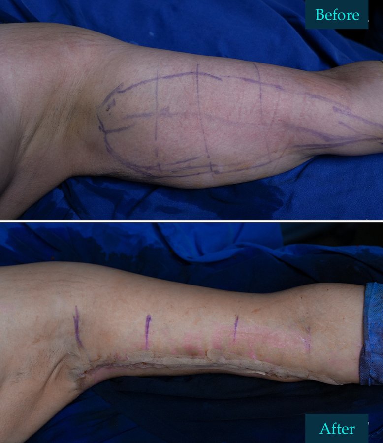 Gokhan Semerci Clinic - Gokhan Semerci Clinic