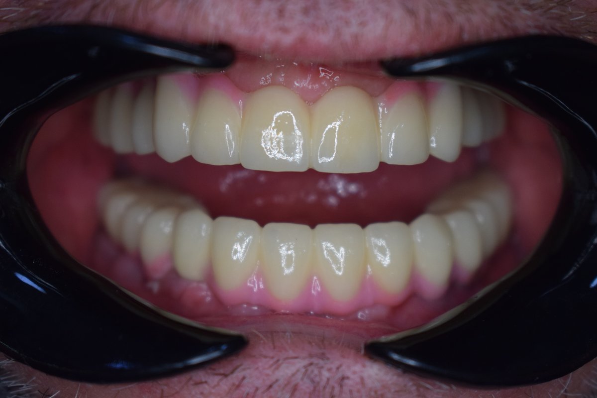 Golden Dental - Tiranë - Golden Dental - Tiranë