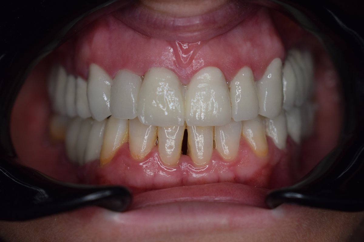 Golden Dental - Tiranë - Golden Dental - Tiranë