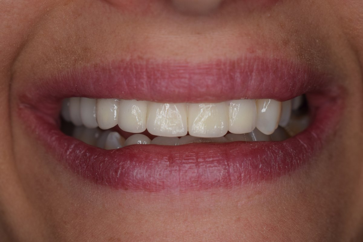 Golden Dental - Tiranë - Golden Dental - Tiranë