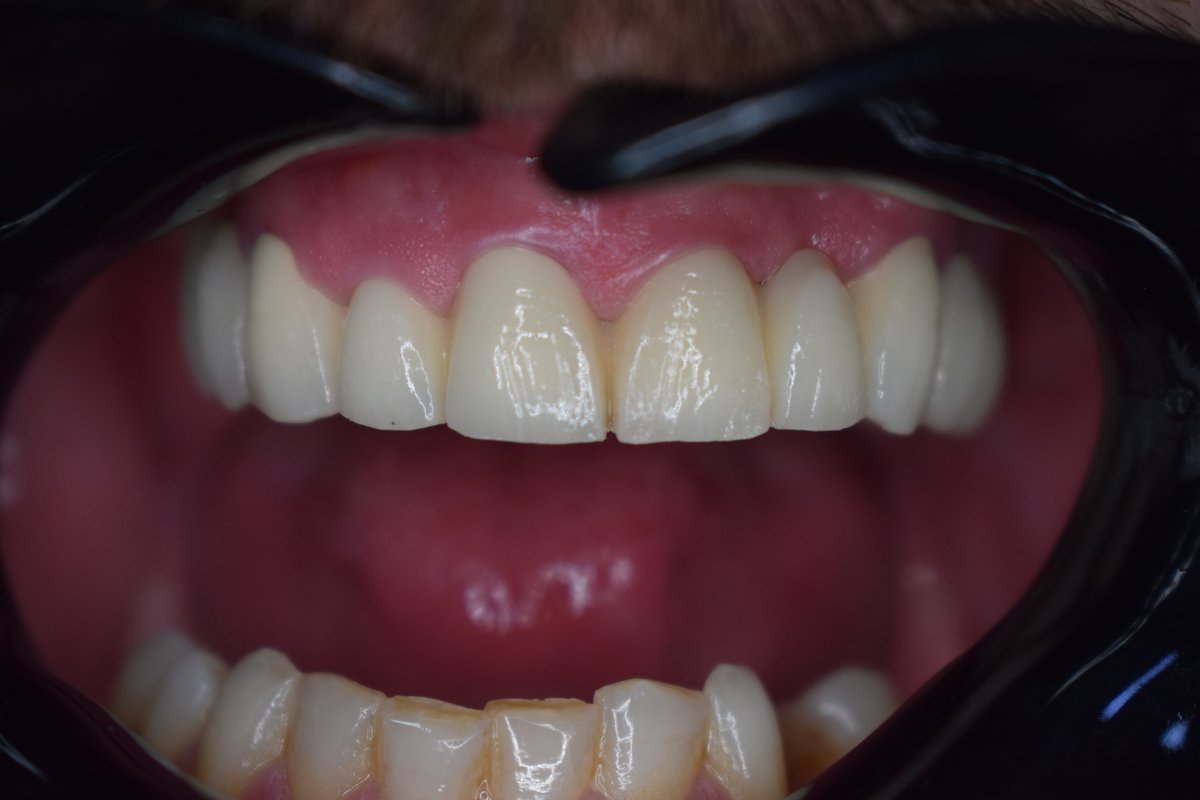 Golden Dental - Tiranë - Golden Dental - Tiranë