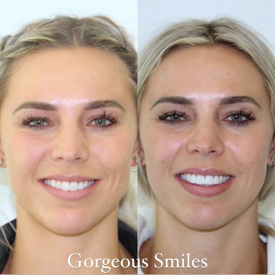 Gorgeous Smiles Dentistry - Gorgeous Smiles Dentistry