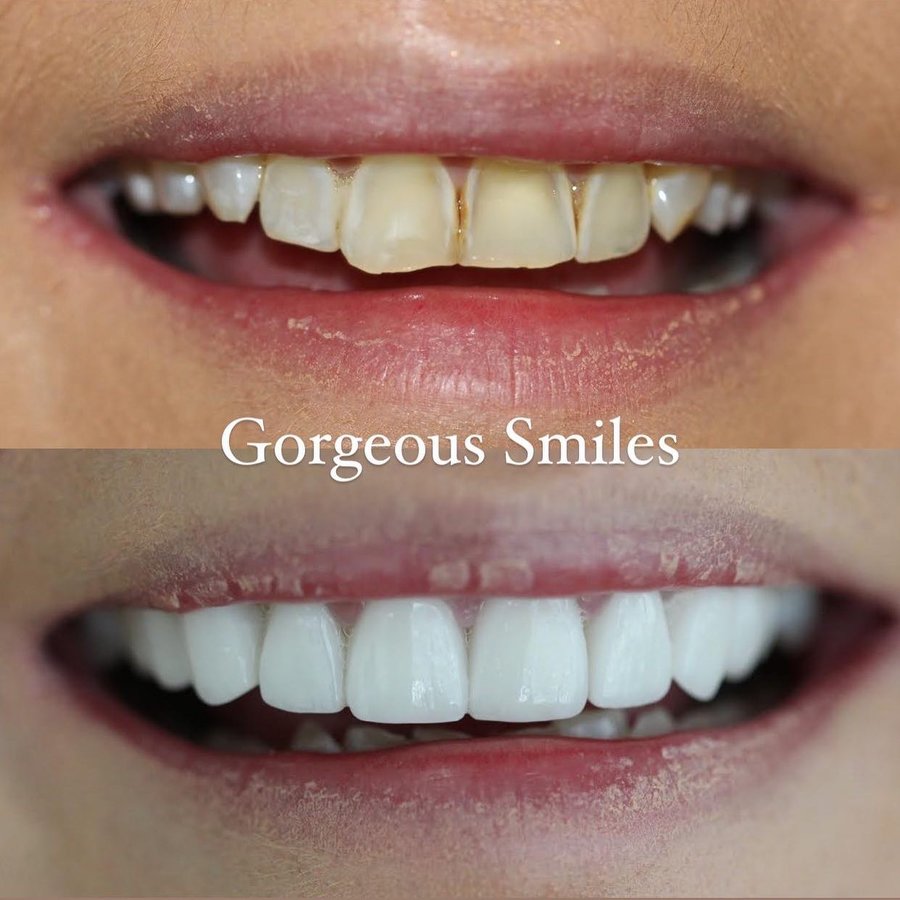 Gorgeous Smiles Dentistry - Gorgeous Smiles Dentistry