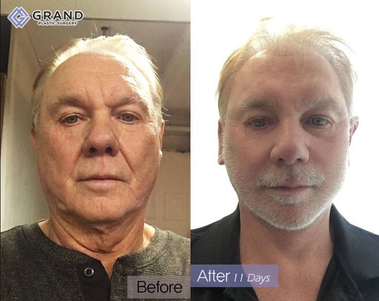 Grand Plastic Surgery - Grand Plastic Surgery
