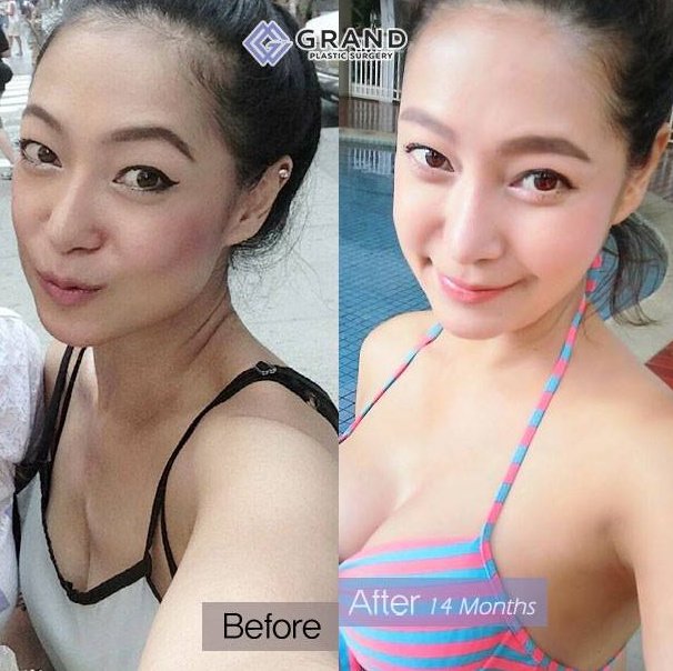 Grand Plastic Surgery - Grand Plastic Surgery