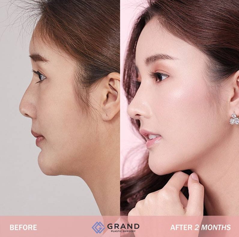 Grand Plastic Surgery - Grand Plastic Surgery