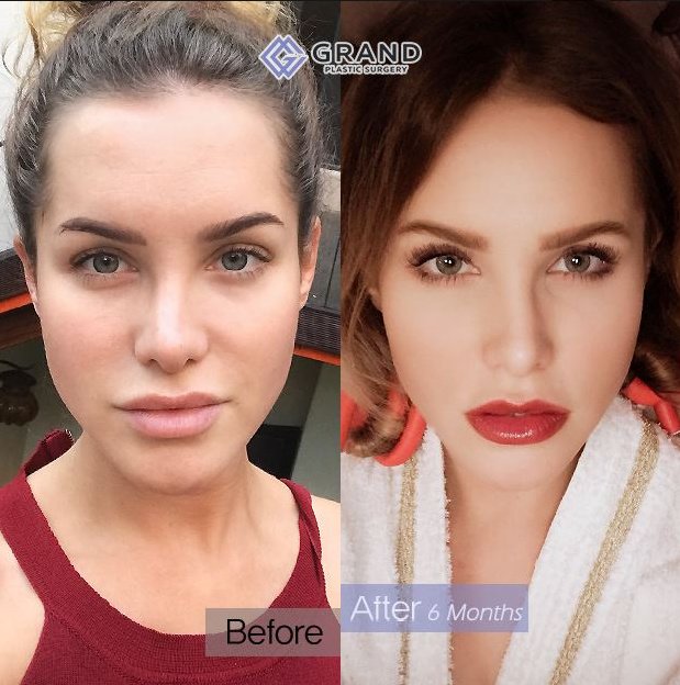 Grand Plastic Surgery - Grand Plastic Surgery