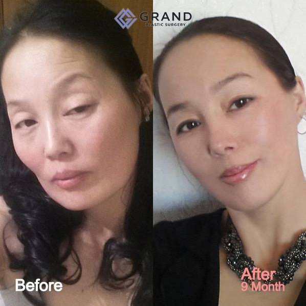 Grand Plastic Surgery - Grand Plastic Surgery