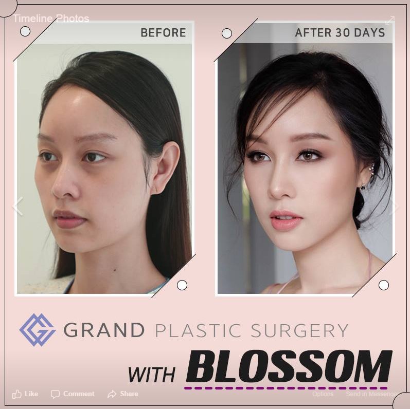 Grand Plastic Surgery - Grand Plastic Surgery