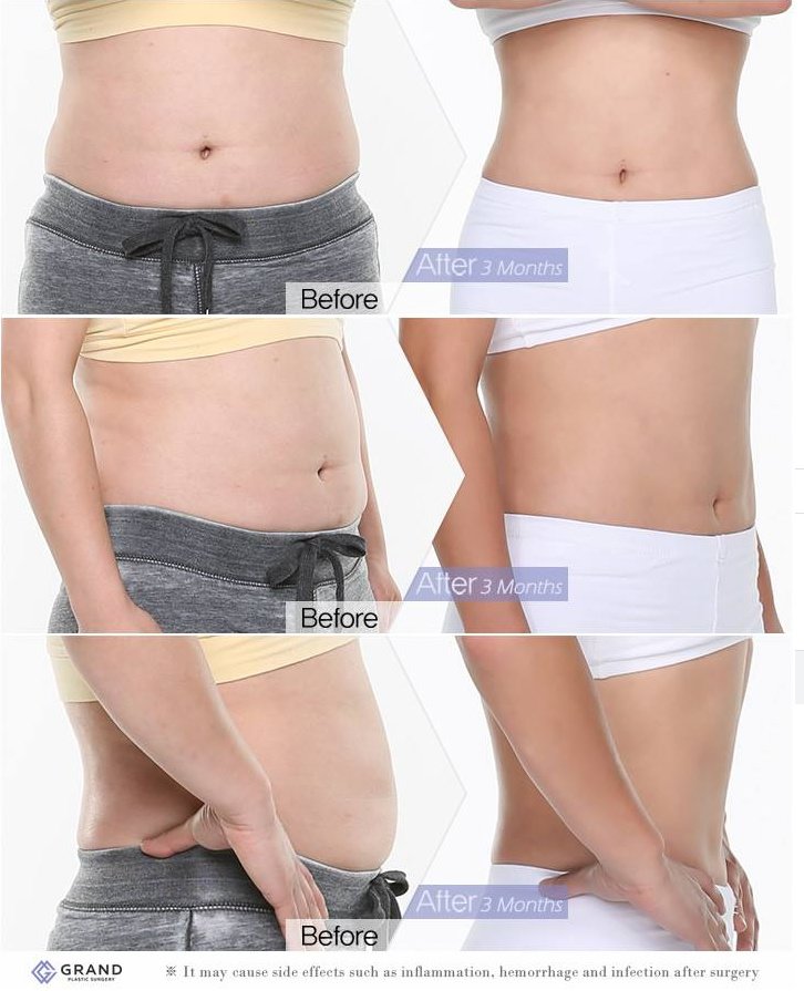 Grand Plastic Surgery - Grand Plastic Surgery