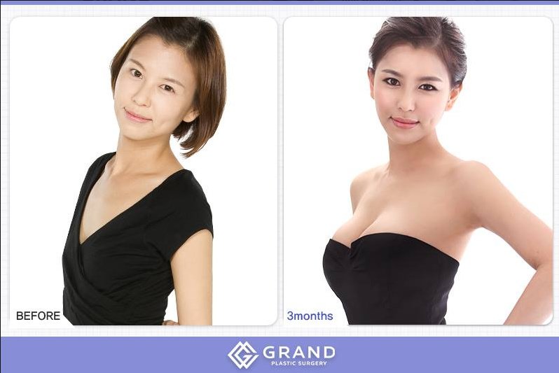 Grand Plastic Surgery - Grand Plastic Surgery