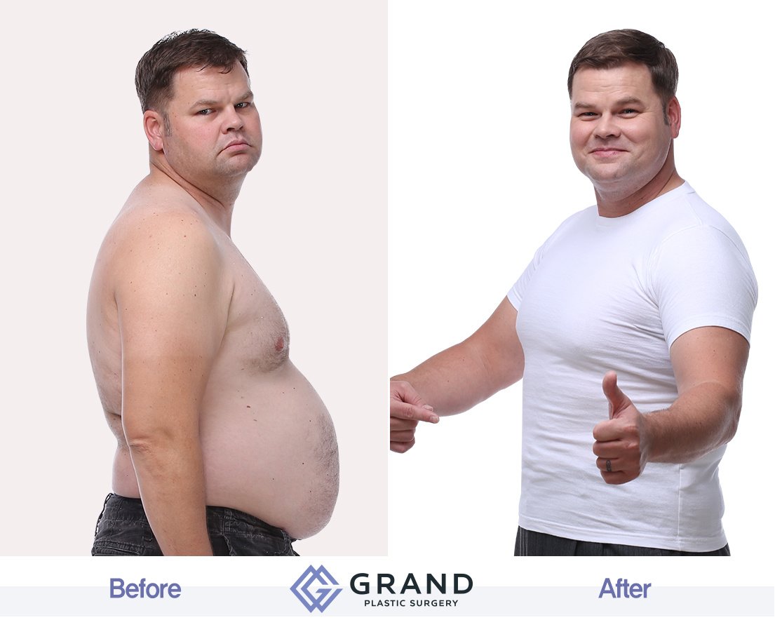 Grand Plastic Surgery - Grand Plastic Surgery