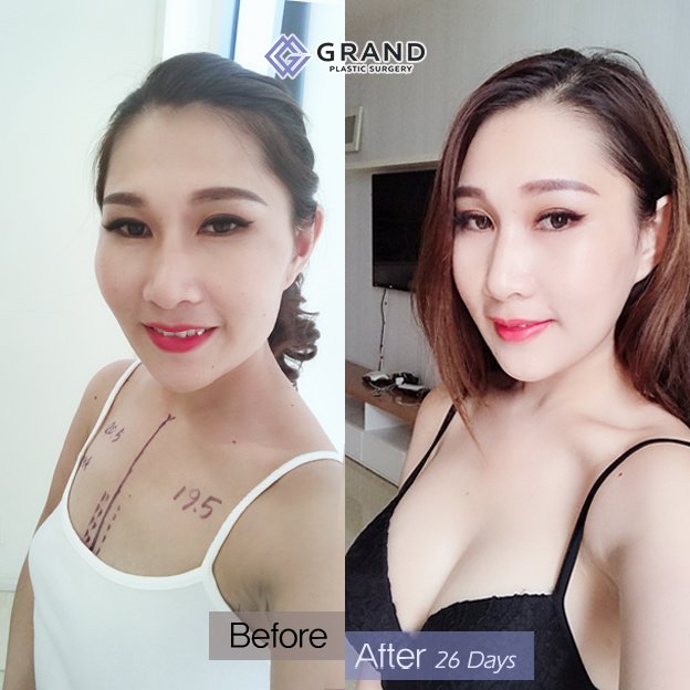 Grand Plastic Surgery - Grand Plastic Surgery