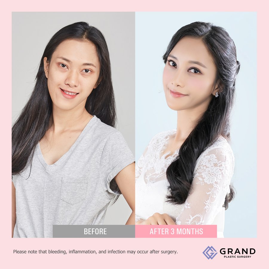 Grand Plastic Surgery - Grand Plastic Surgery
