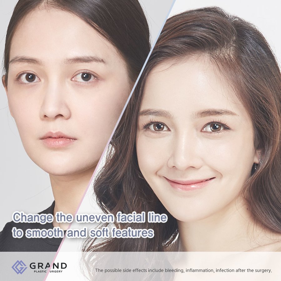 Grand Plastic Surgery - Grand Plastic Surgery