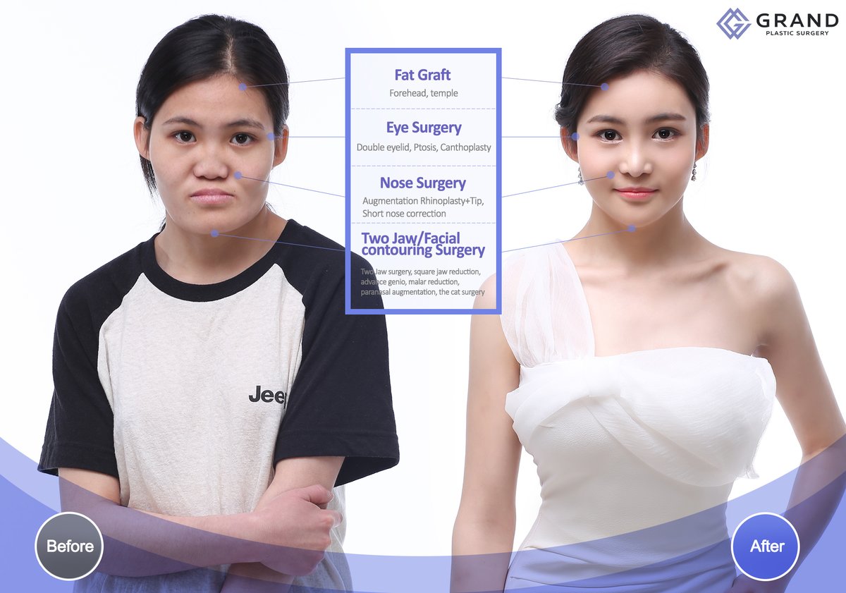 Grand Plastic Surgery - Grand Plastic Surgery