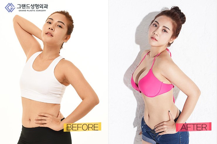 Grand Plastic Surgery - Grand Plastic Surgery