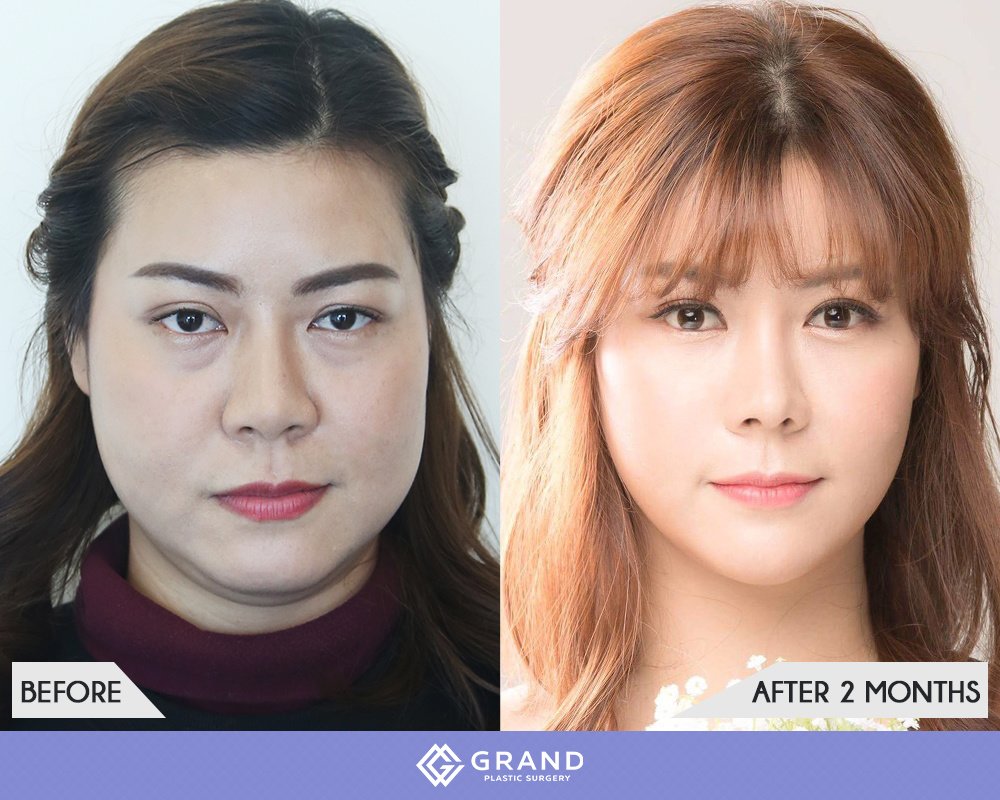 Grand Plastic Surgery - Grand Plastic Surgery