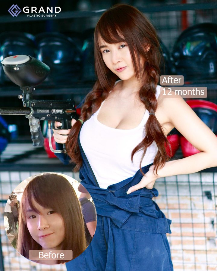 Grand Plastic Surgery - Grand Plastic Surgery