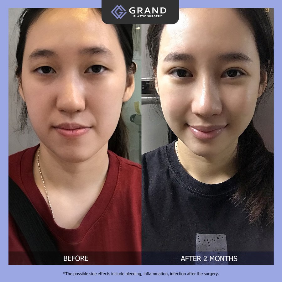 Grand Plastic Surgery - Grand Plastic Surgery