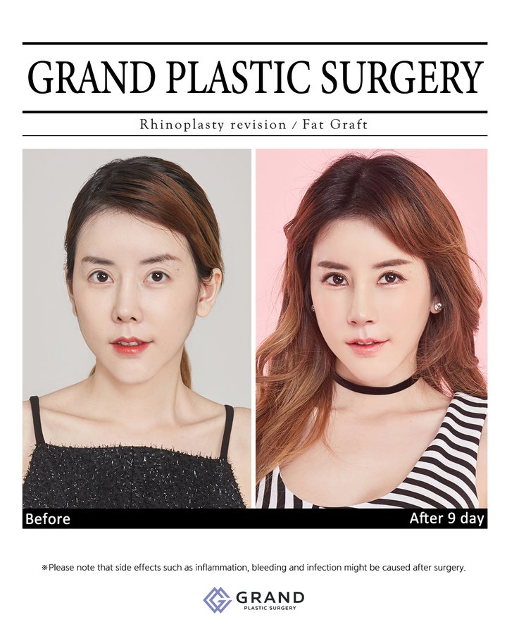 Grand Plastic Surgery - Grand Plastic Surgery
