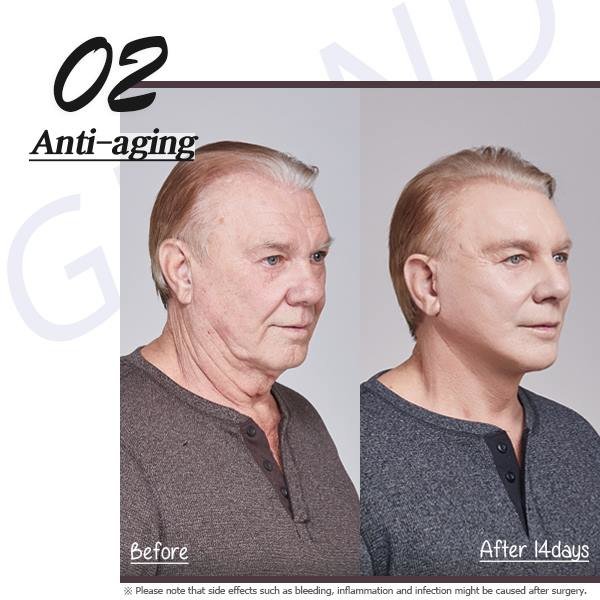 Grand Plastic Surgery - Grand Plastic Surgery