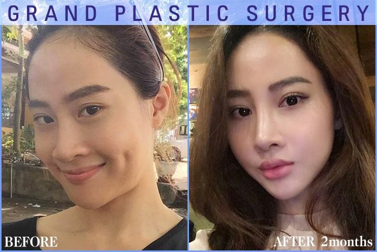 Grand Plastic Surgery - Grand Plastic Surgery