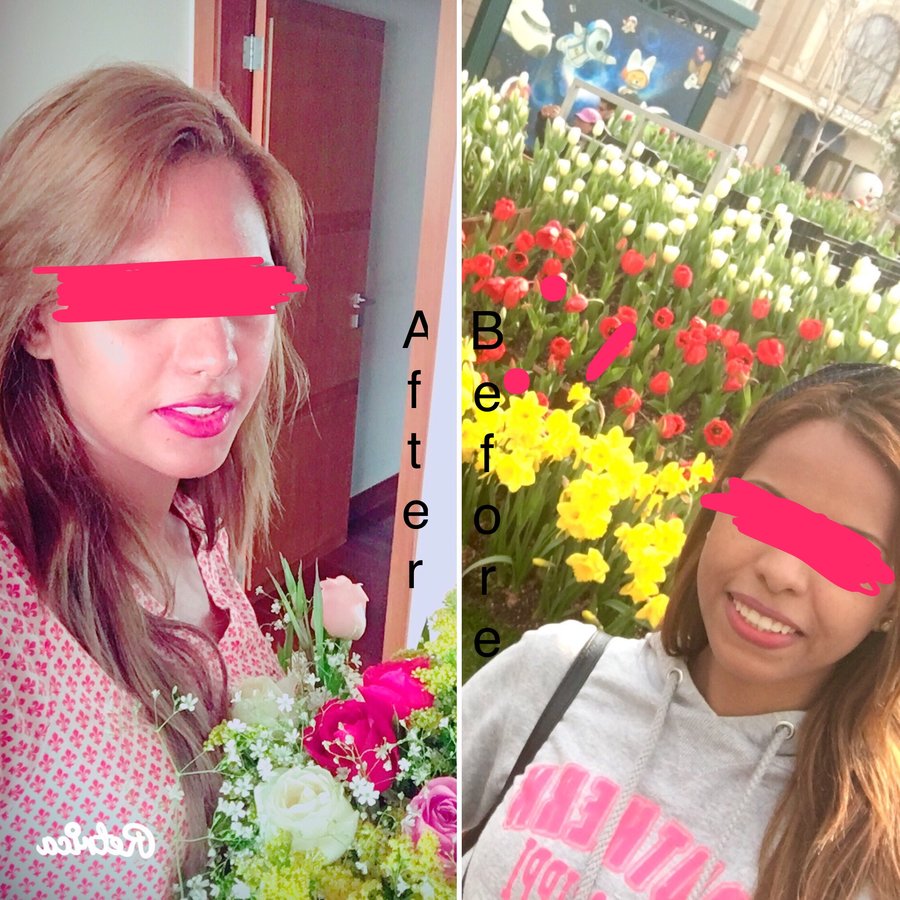 Grand Plastic Surgery - Grand Plastic Surgery