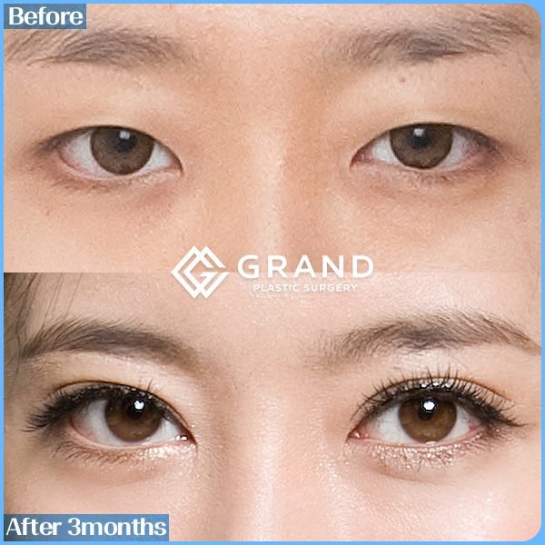 Grand Plastic Surgery - Grand Plastic Surgery