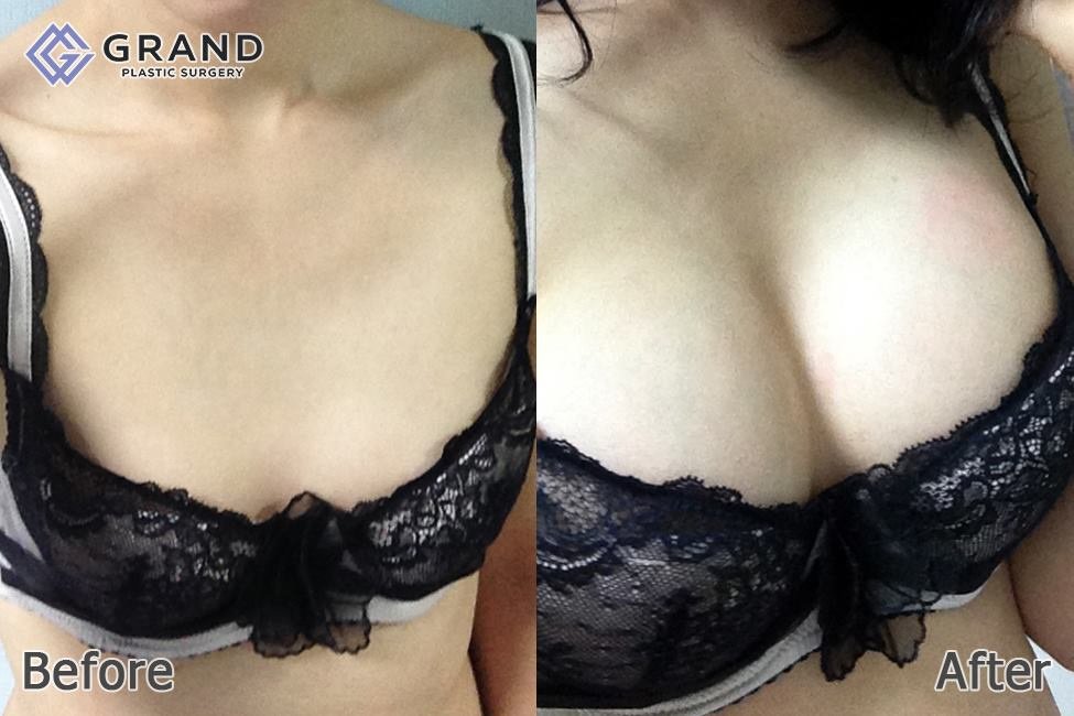 Grand Plastic Surgery - Grand Plastic Surgery