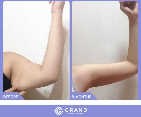 Grand Plastic Surgery - Grand Plastic Surgery