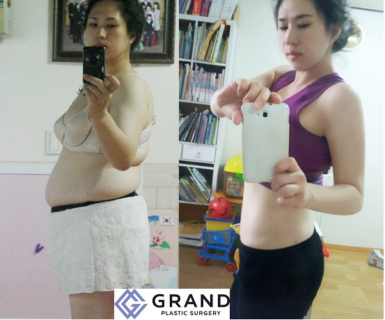 Grand Plastic Surgery - Grand Plastic Surgery