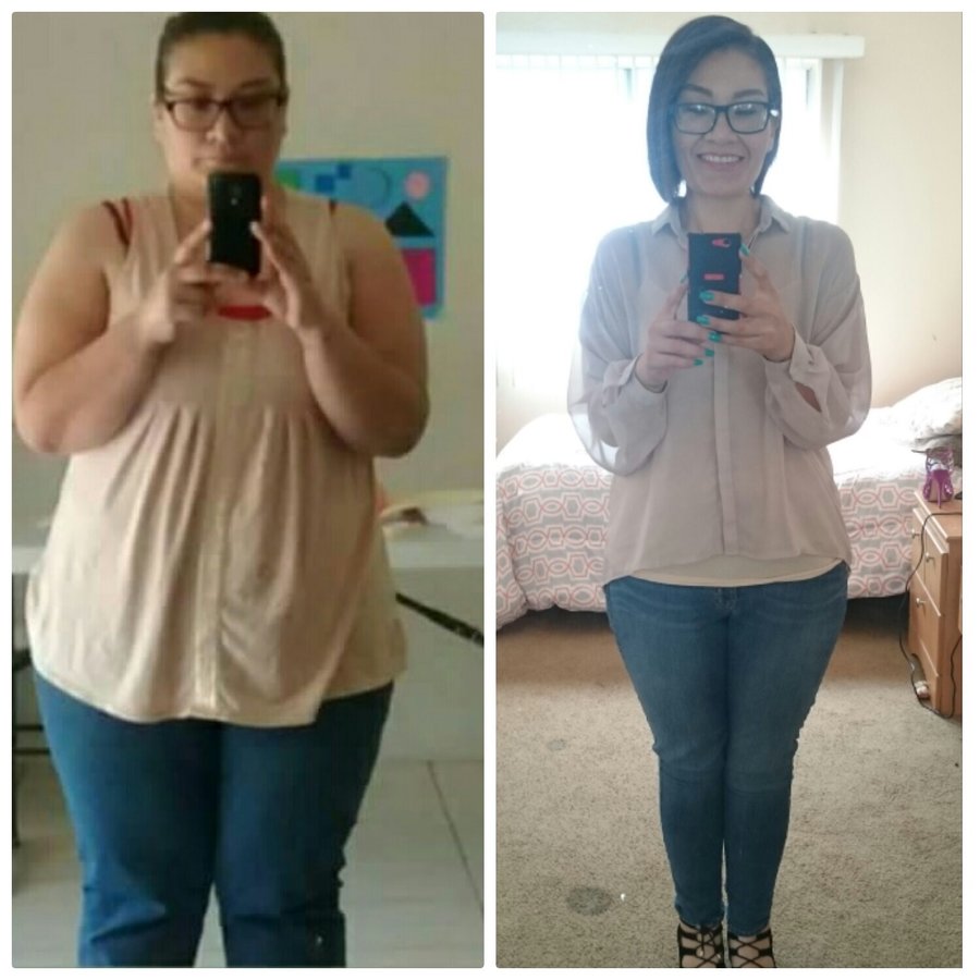 Grand View Hospital - Grand View Hospital