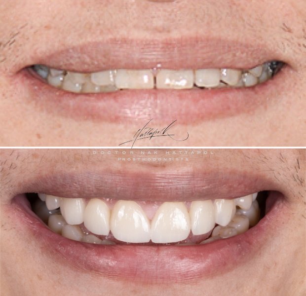 عيادة جراند دينت لطب الأسنان - GrandDent Dental Clinic