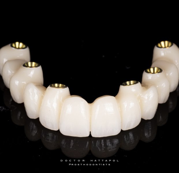 عيادة جراند دينت لطب الأسنان - GrandDent Dental Clinic