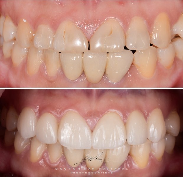 عيادة جراند دينت لطب الأسنان - GrandDent Dental Clinic