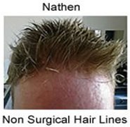 مركز جريت لوكينج للشعر - Great Looking Hair Centre