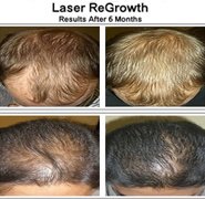 مركز جريت لوكينج للشعر - Great Looking Hair Centre
