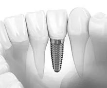 Green Street Dental Practice - Green Street Dental Practice