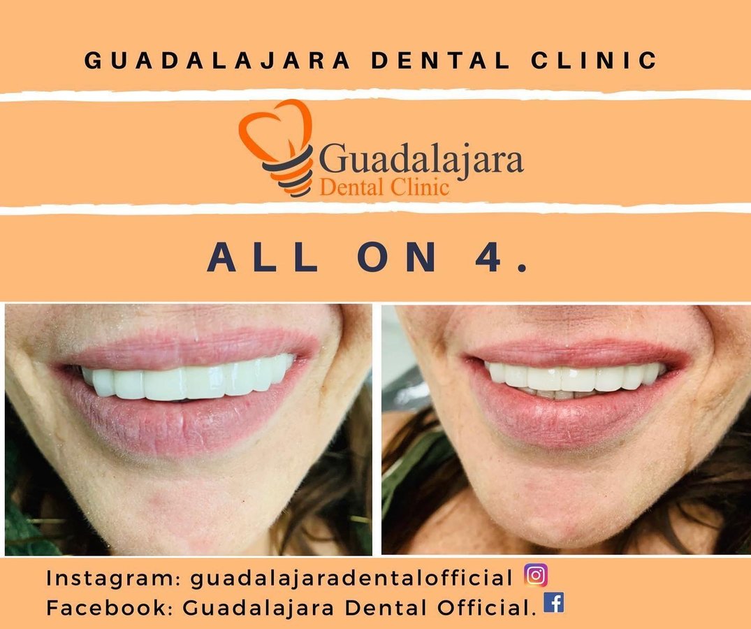 Guadalajara Dental Clinic - Guadalajara Dental Clinic